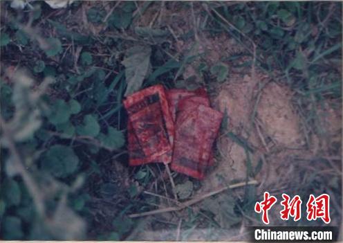 ͼΪ�����ֳ������Ĵ�Ѫ�������(��Ƭɨ���)���������й����������־ֹ�ͼ ��