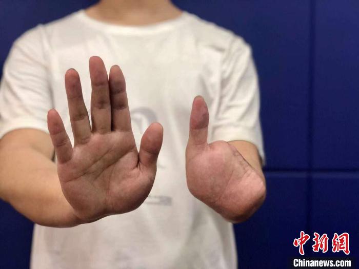 һС�ﱻƭ���山�ܾ���թ����4����ָ