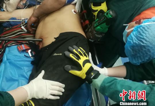 安徽一工人高空坠落遭钢筋穿体消防医院合力取出钢筋